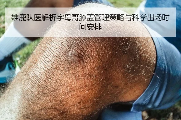雄鹿队医解析字母哥膝盖管理策略与科学出场时间安排